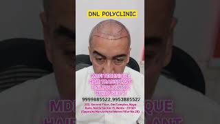 polyclinic haircare transformation hair noida treatment [upl. by Nahs204]