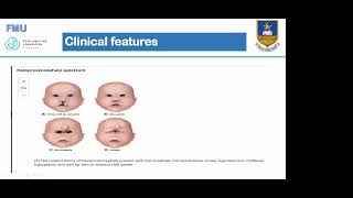 FMU CasesAlobar holoprosencephaly and Advanced Tubal Pregnancy by Dr T Murinye [upl. by Repard]