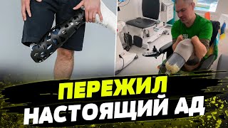 Кадыровцы АМПУТИРОВАЛИ ВСЕ ЧЕТЫРЕ конечности В это СЛОЖНО ПОВЕРИТЬ история украинского защитника [upl. by Ainot]