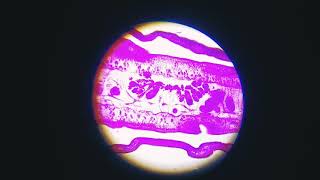 Mature proglottid of Tapeworm Taenia solium under my microscope 10X magnification Biology [upl. by Ydeh]