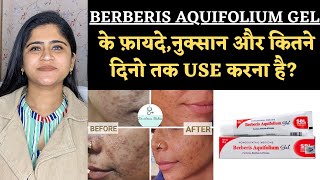 Berberis Aquifolium Gel Benefits amp Side effects ॥ कितने दिन में Results मिलते है [upl. by Smailliw86]