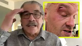 TYSON FURY NEEDS A WORLDCLASS CUTMAN  Legendary Stitch Duran READY TO HELP vs Usyk [upl. by Jeraldine]