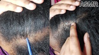 ASMR  Scalp Scratching amp Hair Greasing [upl. by Juliana313]