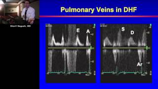 Heart Failure I Sherif Nagueh MD January 5 2016 [upl. by Joanne334]