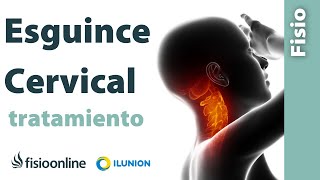 Ejercicios y Estiramientos para Tratar el Esguince Cervical [upl. by Nodab]