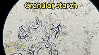 Granular starch in Stool sample stooltest stoolanalysis stoolexamination فحص الخروج [upl. by Lizette619]