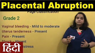 Antepartum Hemorrhage in Hindi  Placental Abruption Clinical Types Grading Signs  Nursing Lecture [upl. by Flyn83]