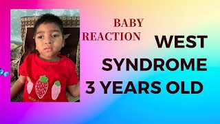 infantile spasms baby infantile spasms baby video west syndrome seizure west syndrome kya hota h [upl. by Ybbil359]