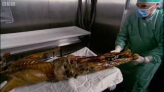 Preserving the body  Death of the Iceman  BBC [upl. by Hplodur]