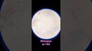 Rhizopus Veg WM at 10X shorts [upl. by Glendon714]