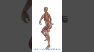 팔꿈치 관절  청소년 박리성 골연골염의 이해 Elbow Joints Understanding Osteochondritis Dissecans in Adolescents [upl. by Enaols701]