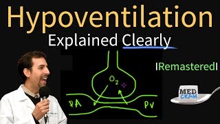 Hypoventilation and Hypoxemia Explained Clearly  Remastered [upl. by Doomham]