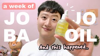 I Tried JOJOBA OIL On My Skin Everyday For a Week And This Happened  Korean Skincare [upl. by Neehsar]