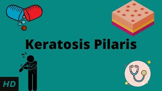 Keratosis Pilaris Causes Signs and Symptoms Diagnosis and Treatment [upl. by Yablon622]