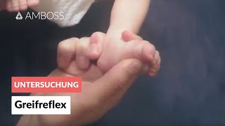 Greifreflex  Frühkindliche Reflexe  AMBOSS Video [upl. by Dorris169]