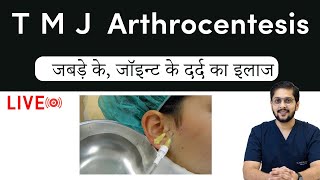 TMJ Arthrocentesis  Best treatment for joint pain  इंदौर मे जबड़े के जॉइन्ट के दर्द का इलाज [upl. by Malti]