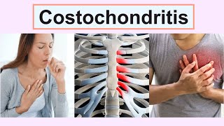 costochondritis [upl. by Nanaek]