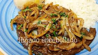 HÍGADO ENCEBOLLADO [upl. by Aivle]