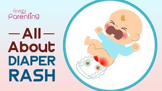 Diaper Rash in Babies – Symptoms Causes and Remedies [upl. by Abbotsen]