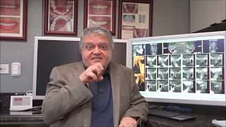 How to Cure Jaw Pain with TMJ Splint Therapy  Dr Parsa Zadeh [upl. by Kenyon441]