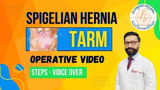 Spigelian Hernia TARM  Laparoscopic  Minimal Editing  Steps  Voice Over [upl. by Oicafinob]