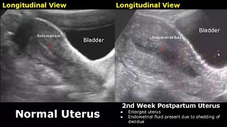 Gynecological amp Obstetric Ultrasound Normal Vs Abnormal Scan  Uterus Ovary Cervix Pregnancy USG [upl. by Metzger440]