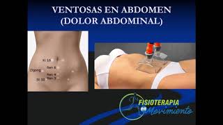 ¿SABES PARA QUE SE UTILIZAN LAS VENTOSAS EN ABDOMEN [upl. by Atsylac]