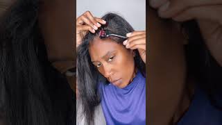 How to GROW your Edges and Bald Spots back in [upl. by Prudi]