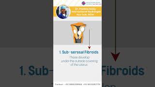 what is uterine fibroid types of fibroids and best treatment [upl. by Ahsirat]