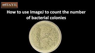 How to use ImageJ software to count the number of bacterial colonies [upl. by Viscardi]