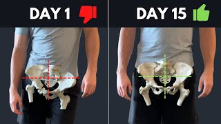 The Best Resource On The Internet For Fixing Lateral Pelvic Tilt asymmetrical hips [upl. by Airyt]