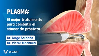 🚨¡Tratamiento para el Agrandamiento de Próstata  Vaporización con PLASMA [upl. by Gerladina]