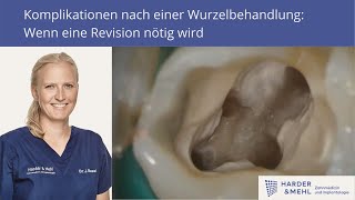 Komplikationen nach einer Wurzelbehandlung Wenn eine Revision nötig wird [upl. by Nuy]