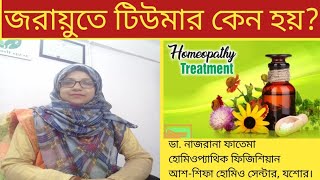 জরায়ুতে টিউমার কেন হয় Uterine fibroids Dr Nazrana Fatema [upl. by Kara-Lynn857]