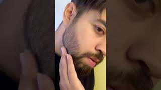 How to fix your PATCHY beard HACK shorts beard beardgrowth [upl. by Siward988]