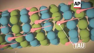 CTE How Repeated Head Blows Affect the Brain [upl. by Kramnhoj]