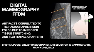 THE ARTIFACTS CORRELATED TO THE RADIOGRAPHER IN DIGITAL MAMMOGRAPHY SKIN FOLDS VIDEO 2 [upl. by Zuliram]