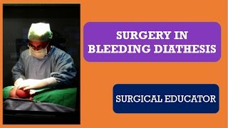 SURGERY IN BLEEDING DIATHESIS [upl. by Sivia]