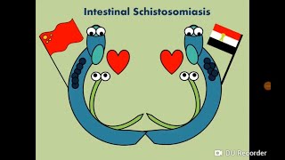 Schistosoma mansoni Blood Fluke  Intestinal SchistosomiasisBilharziasis البلهارسيا [upl. by Edelson588]