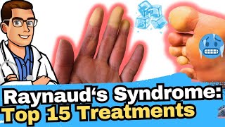 Raynauds Syndrome vs Phenomenon vs Disease Why Are My Toes Cold [upl. by Aenit]