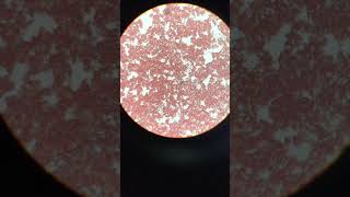 Heartworm microfilaria blood smear [upl. by Mechelle]