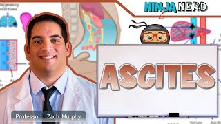 Ascites  Clinical Medicine [upl. by Zachariah]