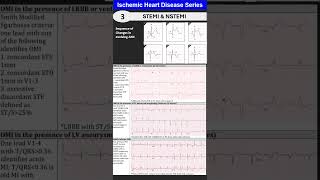 Ischemic Heart Disease 3 Myocardial Infarction STEMI amp NSTEMI [upl. by Redna]