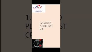 Choroid plexus cyst  Antenatal scan  Downs syndrome choroidplexuscyst [upl. by Julieta]