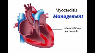 Myocarditis History Management mrcpch Clinical [upl. by Rainwater463]