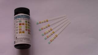 How to read Urine Testing strips results What can you test for with a urine dip test strip [upl. by Malkah]