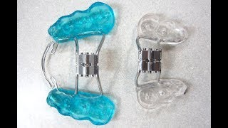 Several different orthodontic appliances 1 [upl. by Godiva]