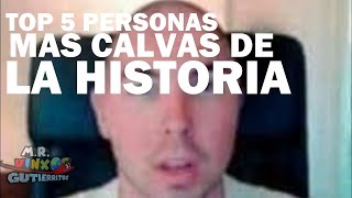 TOP 5 PERSONAS MAS CALVAS DE LA HISTORIA [upl. by Nylahsoj706]