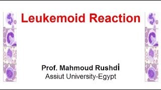 Leukemoid Reaction Arabic 2017 [upl. by Stets]