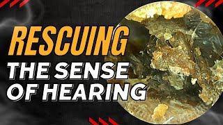 Rescuing The Sense Of Hearing [upl. by Asir]